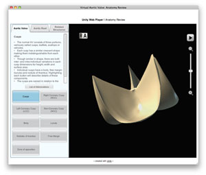 screen capture of Virtual Aortic Valve Anatomy Review module